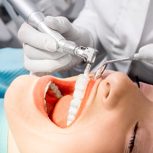 Ультразвуковая чистка зубов предполагает удаление зубного камня и налета при помощи ультразвукового лазера.